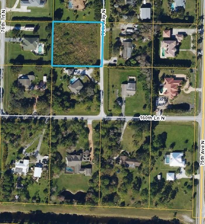 75th Way, Palm Beach Gardens, FL 33418